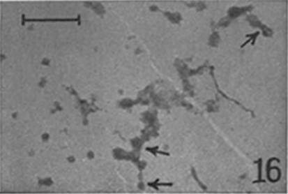 micrograph of a fraction containing microsome, see caption below