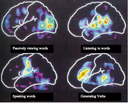 pet scan images