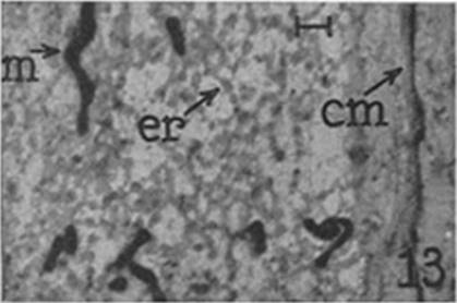 micrograph of a thin-sliced preparation from a cell showing the endoplasmic reticulum, see caption below